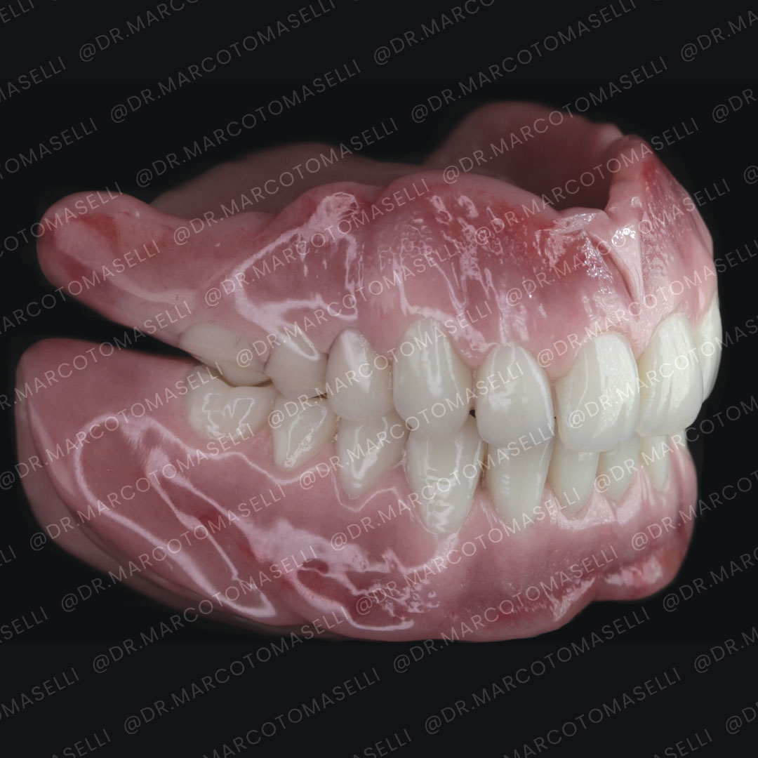 Dentiera di qualità