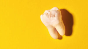 dente del giudizio