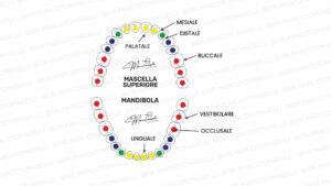 mesiale occlusale