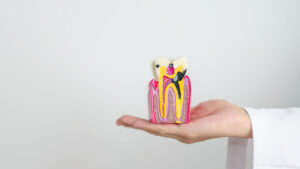 dente sano devitalizzato
