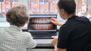 pianificazione trattamento bocca abrasa