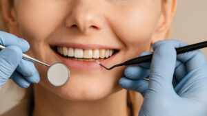 bonding dentale → Dott. Marco Tomaselli bonding dentale