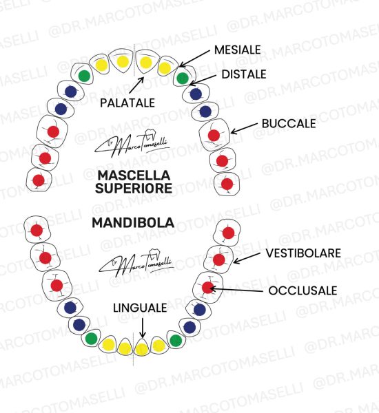 mesiale occlusale